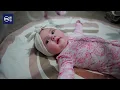 Jaycie s journey The rare surgery that happened before birth