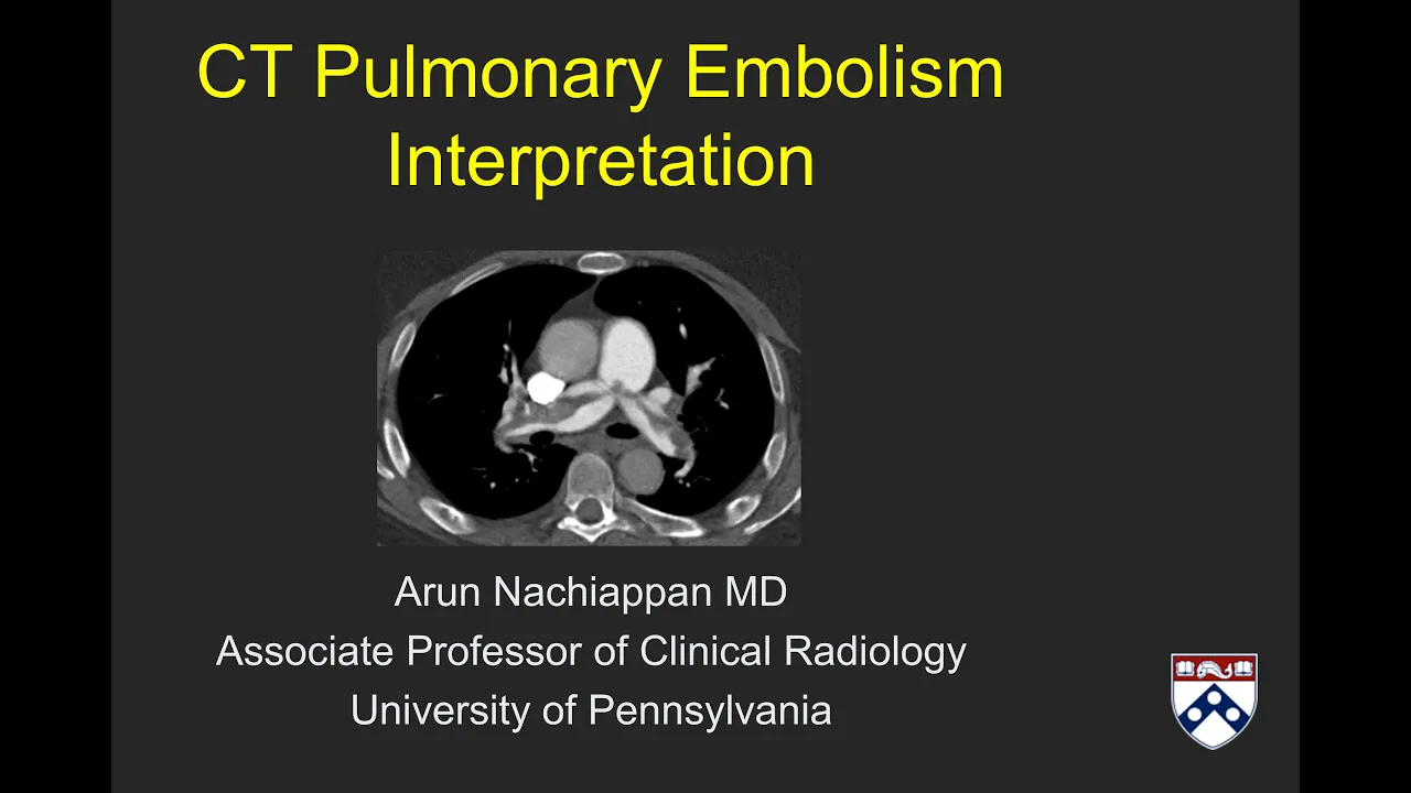 CT Pulmonary Embolism Interpretation