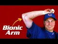 The Tommy John Surgery Revolution and its MASSIVE Impact on Baseball
