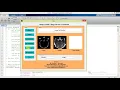 Matlab Project on Image Fusion Using Curvelet Transform