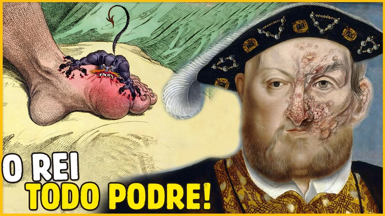 7 DOENÇAS SURPREENDENTES DE HENRIQUE VIII QUE VOCÊ NÃO SABIA