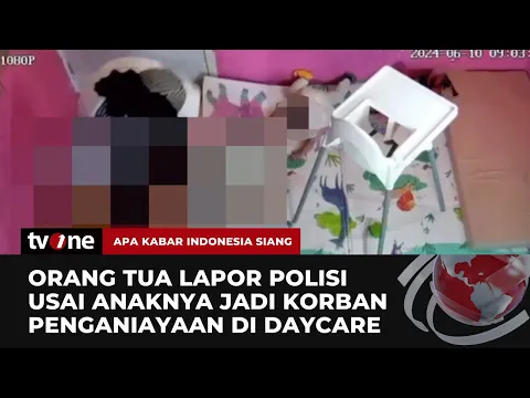 Soal Penganiayaan Balita di Daycare, Orang Tua Korban Lapor ke Polisi |