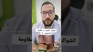 التصبغات الجلدية المصاحبة لمقاومة الانسولين مش بتختفي    دندنها