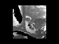 ROFFS Bahamas Circulation Zoom - Jan 15