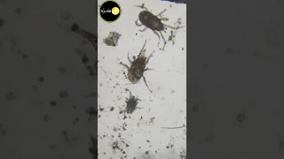 حشرات مجهرية في اندومي  اندومي  إندومي  اندومي عشق دندنها