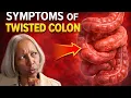 Tortuous Twisted Colon at 65 My Story and How I Stay Healthy