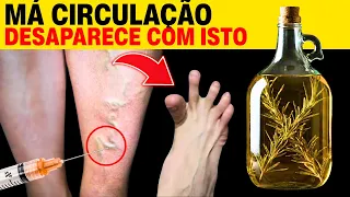 Varizes? Esta Receita Natural com 2 Ingredientes Funciona de Verdade
