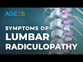 What Are the Symptoms of Lumbar Radiculopathy Spinal Nerve Root Pain Disc Bulge