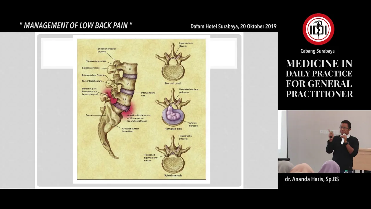 Hernia Nucleus Pulposus (Saraf Kejepit) #3. 