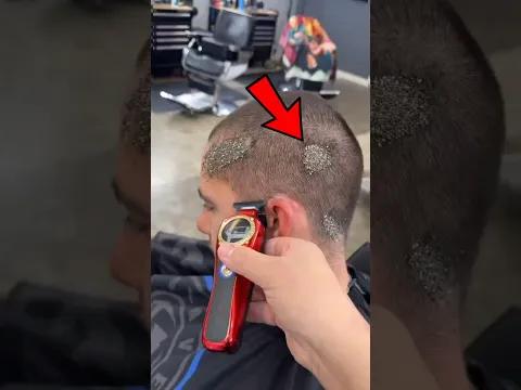 The Barber Found Thousands of Lice 😱