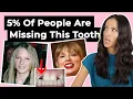 Born With Missing Teeth Hypodontia