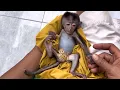 Download Lagu providing therapy for little robin's crooked and stiff fingers