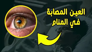 تفسير حلم العين المصابة في المنام ودلالاته الكاملة    تفسير العين في المنام دندنها
