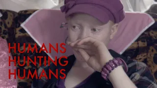 humans hunting humans the murder of albinos in tanzania