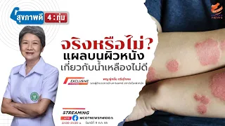 ควรดูแลแผลอย่างไรเมื่อมีน้ำเหลืองซึมออก