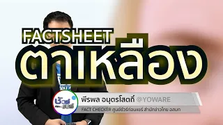 วิตามินสามารถรักษาตาเหลืองจากสาเหตุต่างๆ ได้จริงหรือไม่