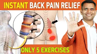 5 Simple Exercises to Relieve Back Pain Fast
