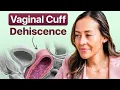 A Surgeon Explains Symptoms Risks Prevention