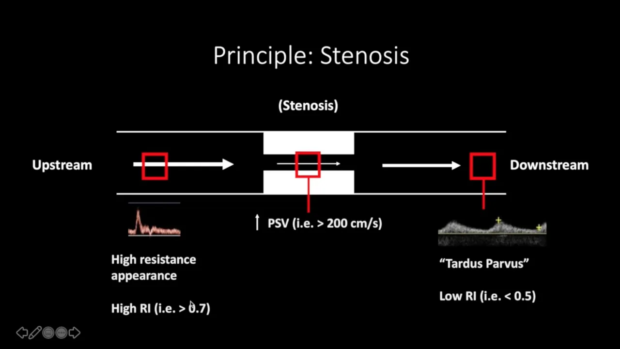 Doppler Ultrasound Part 1 - Principles (w/ focus on Spectral Waveforms)