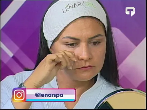 ¿Cómo sanar cicatrices de acné de manera casera?