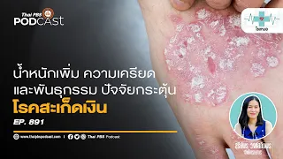 ทำไมการควบคุมน้ำหนักจึงสำคัญกับคนเป็นสะเก็ดเงิน