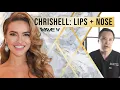 Achieve That Look - Chrishell Stause Lips Nose Achieve The Look With Nose Lip Augmentation