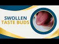 Swollen Taste Buds 6 Signs and Symptoms and Their Cure