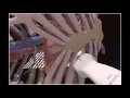 How To Parasternal Long Axis View Echocardiography 3D