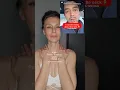 Download Lagu Watch This Before Getting Any Neck Treatments