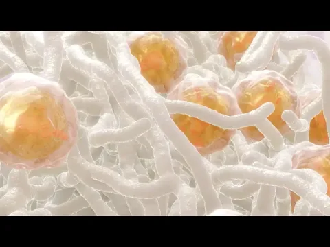 Video: The science behind MACI: unlocking the potential of your patient’s own cells
