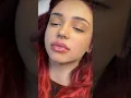 Download Lagu Breskvica prije i poslije operacija 👀