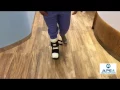 How to walk with a total contact cast TCC