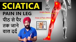 Download Understand Sciatica : पीठ से पैर तक दर्द  | Pain from Back to Legs | Dr.Education Hindi Eng MP3