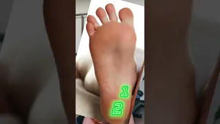ليس كل ألم الكعب هو التهاب اللفافة الأخمصية   ألم الكعب دندنها