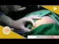 DERMAESTHETIQUE Testosterone pellet insertion