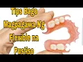 Tips Bago Magpagawa Ng Flexible na Pustiso