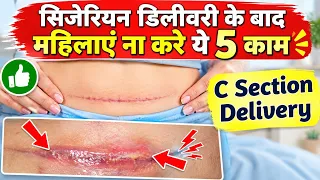 सिजेरियन डिलीवरी के बाद भूलकर भी न करें ये 6 गलतियाँ ❌❌ | Care Tips After C Section