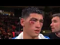 Download Lagu Dmitry Bivol Faced His \