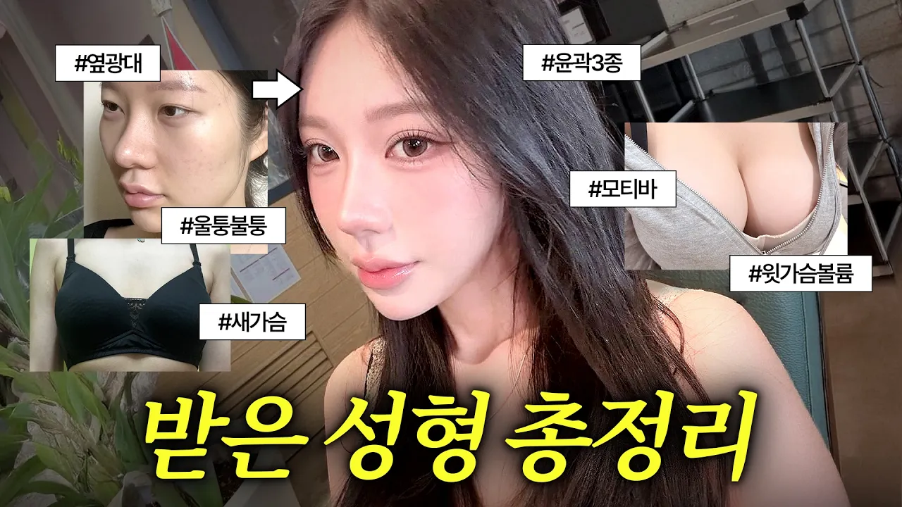 광대 싹 밀고 눈·가슴까지 다 갈아엎었습니다! 🤫✨ | 디에이성형외과