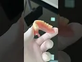 Download Lagu Logramos crear la mejor adherencia de una prótesis total inferior en boca 😃🎉🎉