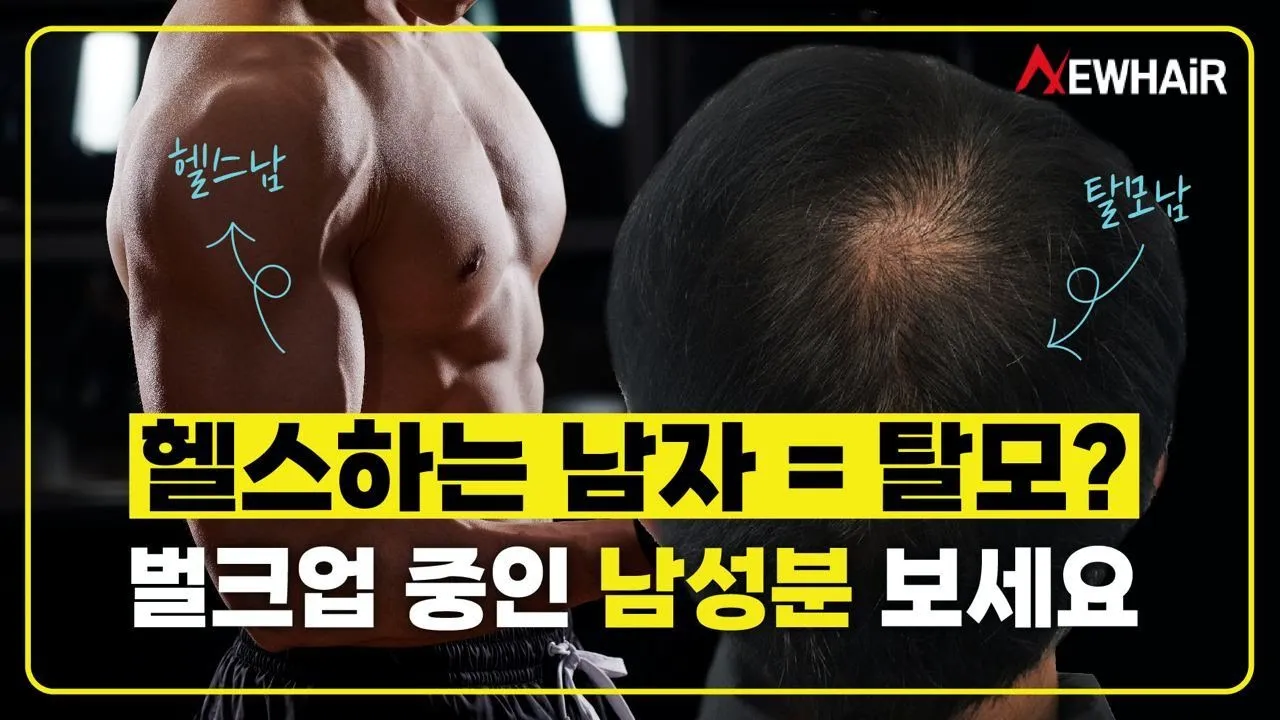 남성탈모! 격한 운동하면 무조건이라고!? (벌크업 중인 남성분들 보세요)ㅣ뉴헤어