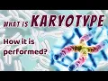 What is Karyotype and How it is Performed