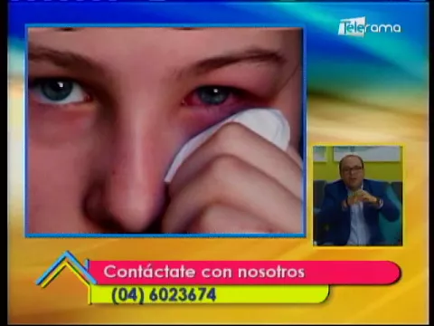 Brote de conjuntivitis en Guayaquil