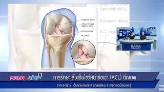 เส้นเอ็นไขว้หน้าข้อเข่าคืออะไร และมีหน้าที่สำคัญอย่างไร?