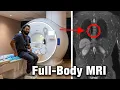 Download Lagu I Did a $2,500 Prenuvo MRI Scan. My Surprising Results