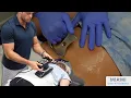 AMAZING Chiropractic Care for Low Back Pain Jeanie Rub Massager Graston and Cupping Therapy