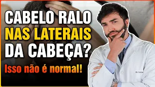 CABELO RALO NAS LATERAIS DA CABEÇA? ISSO NÃO É NORMAL!