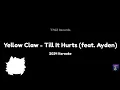 Download Lagu Till It Hurts (feat. Ayden) (Karaoke uit 2024, opgelost)