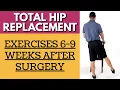 Total Hip Replacement - Exercises 6-9 Weeks After Surgery