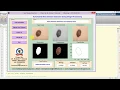 Matlab Code for Skin Disease Detection Using Image Processing IEEE Based Project